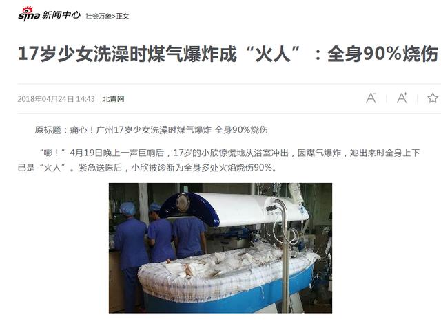 花季少女洗澡時(shí)煤氣爆炸,全身90%燒傷